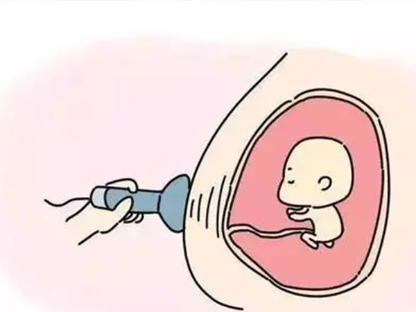 整个孕期的排畸检查有很多