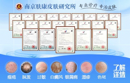 痤疮与青春痘的区别是什么？南京市哪个医院皮肤科比较好？